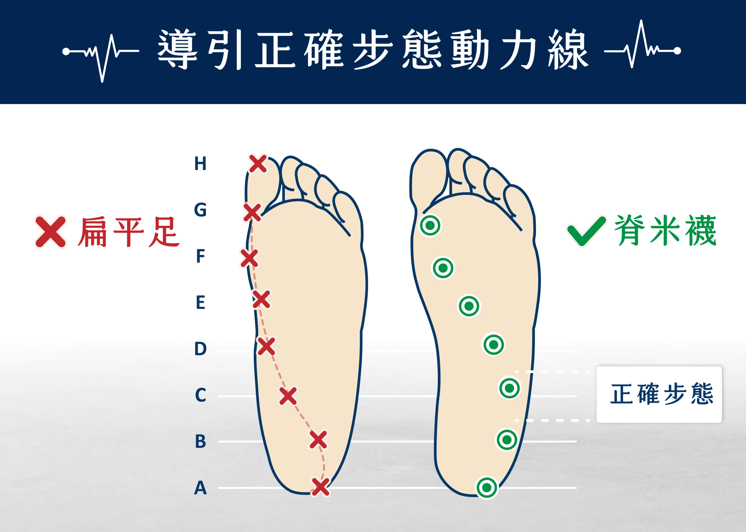 脊米 穿就正